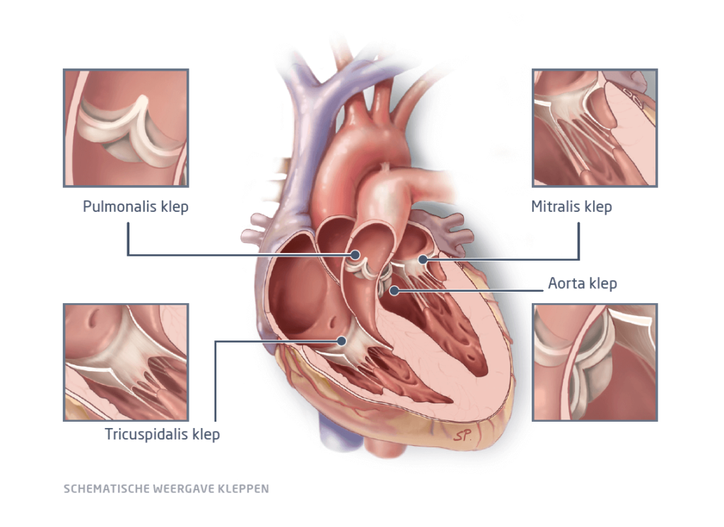 Diagramme informatif sur les valves cardiaques