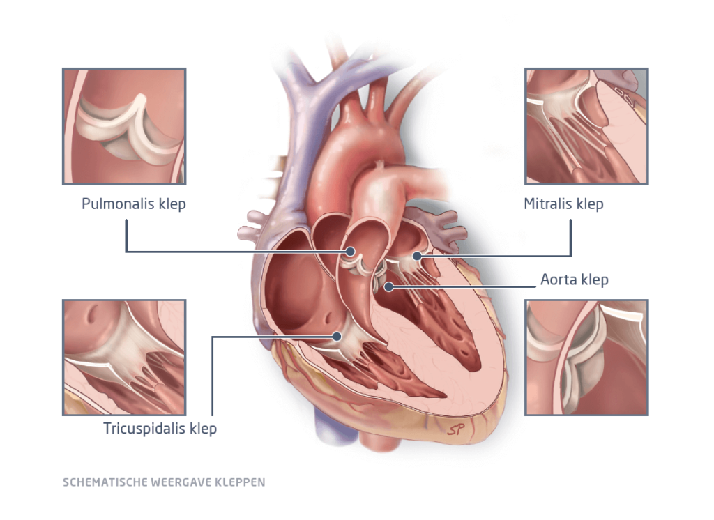 Les valves cardiaques